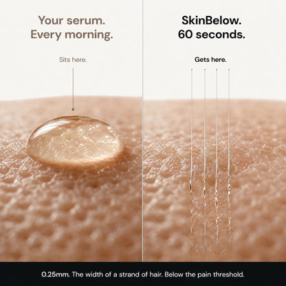 Your serum every morning vs SkinBelow 60 seconds — 0.25mm below the surface